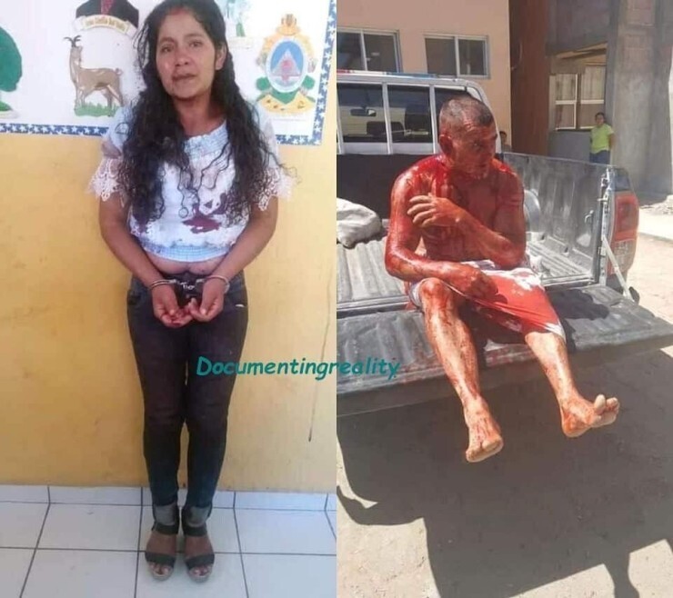 (사진주의) 남편이 바람피는 거 보고 ㅂㅇ을 잘라버린 아내 | 인스티즈