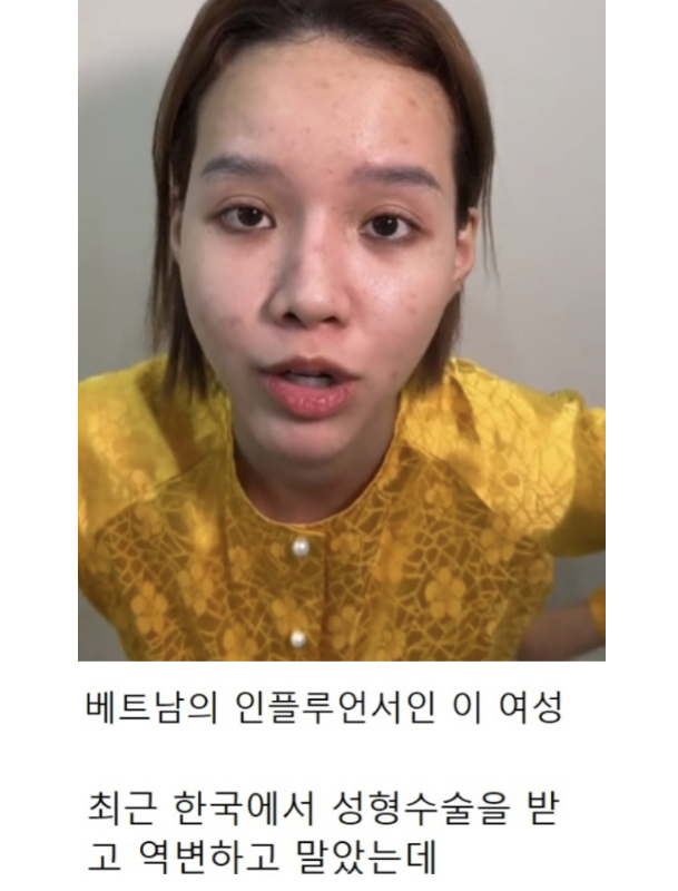 외국인들이 한국와서 성형하는 이유 | 인스티즈