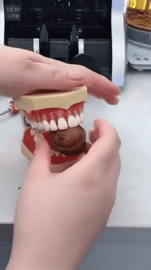 이빨로 호두까면 벌어지는 일 gif | 인스티즈