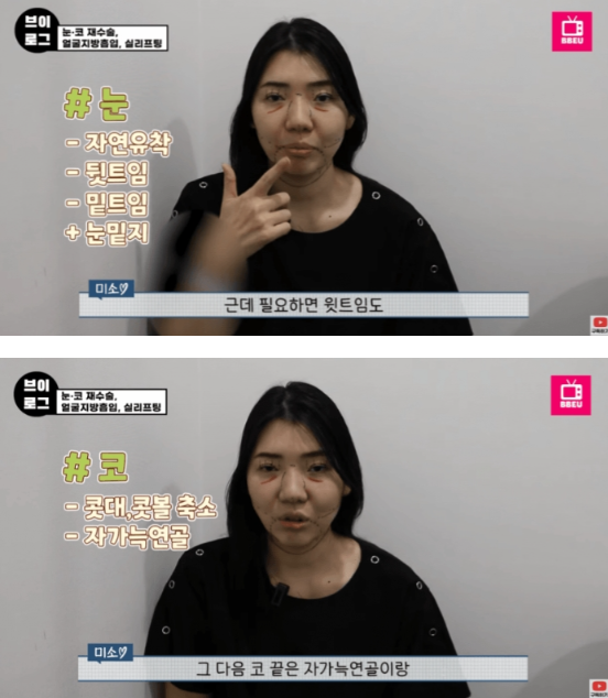 외국인들이 한국와서 성형하는 이유 | 인스티즈