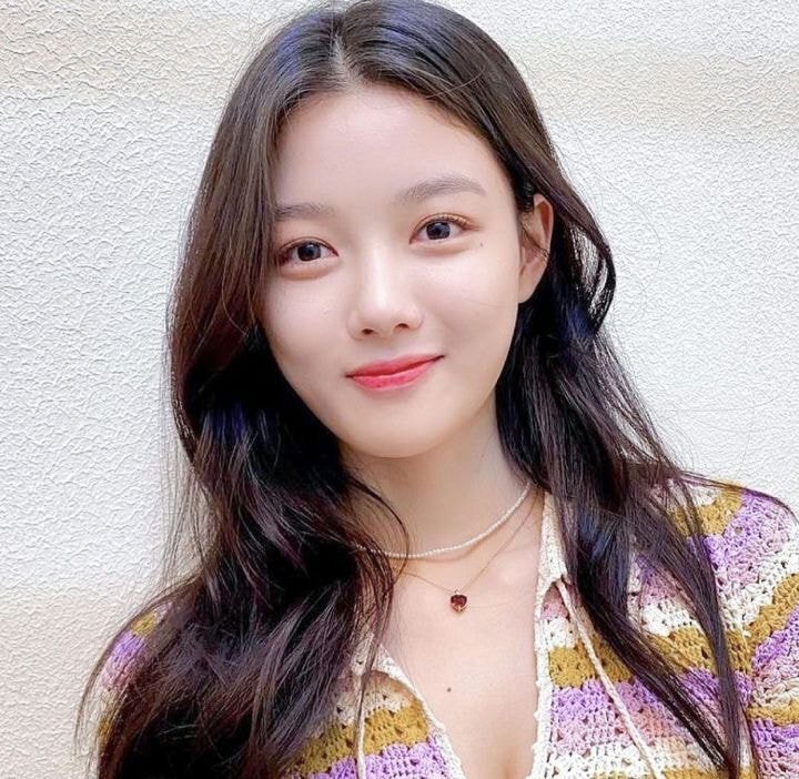 김유정 최근 얼굴.JPGIF | 인스티즈