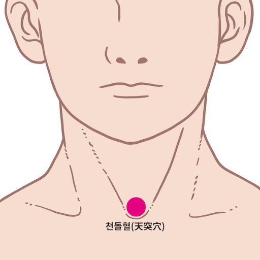 목에 기(氣)가 뭉쳐 생긴 매핵기 증상 특수자석 치료방법 - 특수자석 치료 건강상담 - 마라셀 힐링 라이프 & 몸신 자석건강법 따라하기