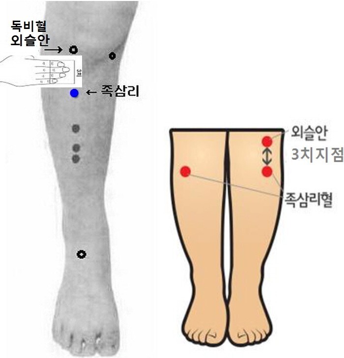 목에 기(氣)가 뭉쳐 생긴 매핵기 증상 특수자석 치료방법 - 특수자석 치료 건강상담 - 마라셀 힐링 라이프 & 몸신 자석건강법 따라하기