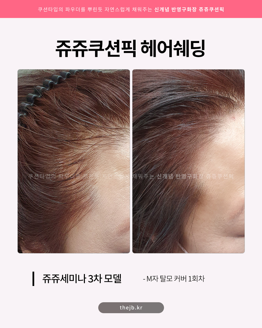제이비라인 이미지