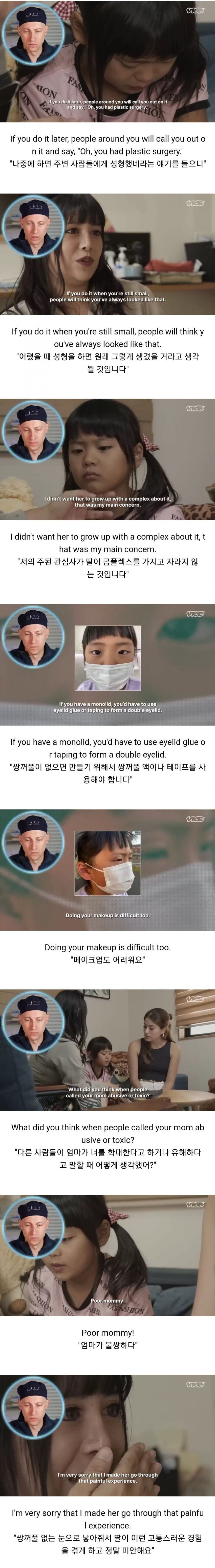 쌍꺼풀 성형수술 받은 일본 초등학생.jpg | 인스티즈