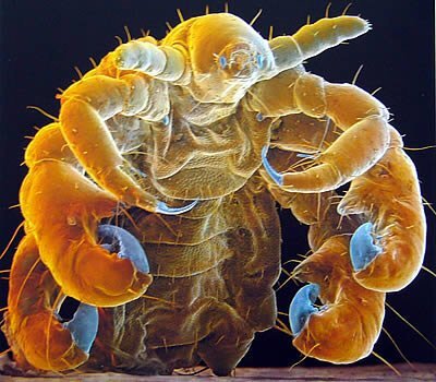 사면발이 확대 모습 .jpg (혐오주의) | 인스티즈