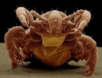 사면발이 확대 모습 .jpg (혐오주의) | 인스티즈