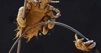 사면발이 확대 모습 .jpg (혐오주의) | 인스티즈