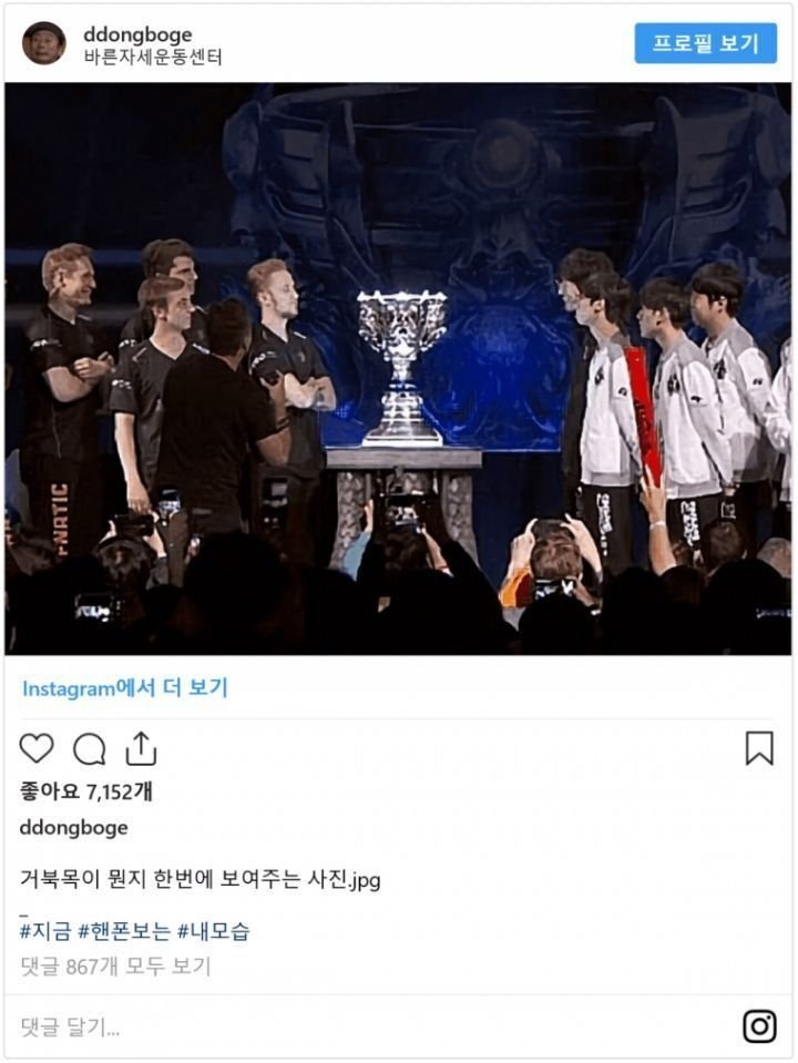 거북목의 확실한 예시 | 인스티즈