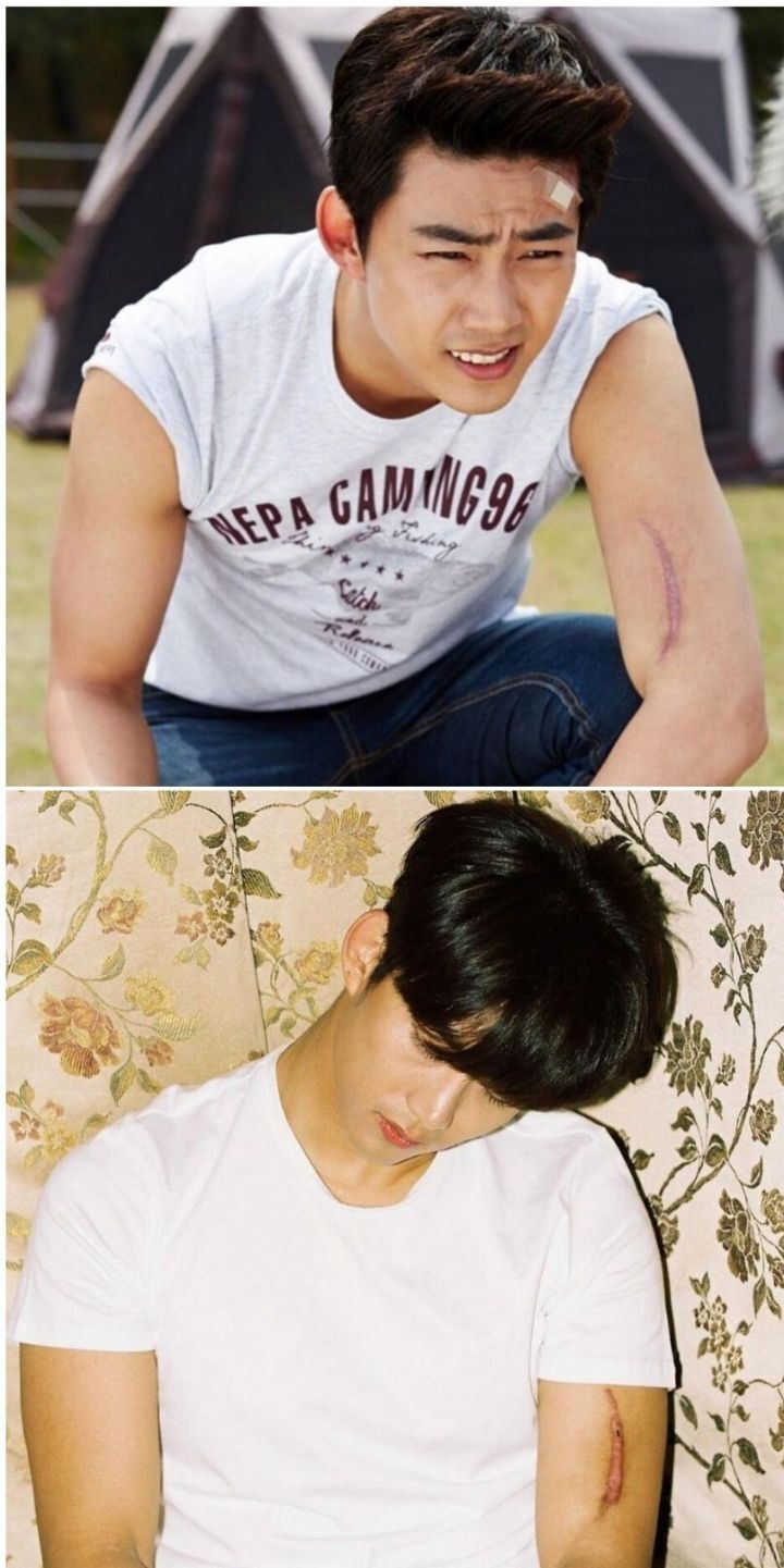 옥택연 팔에 흉터가 있는 이유 | 인스티즈