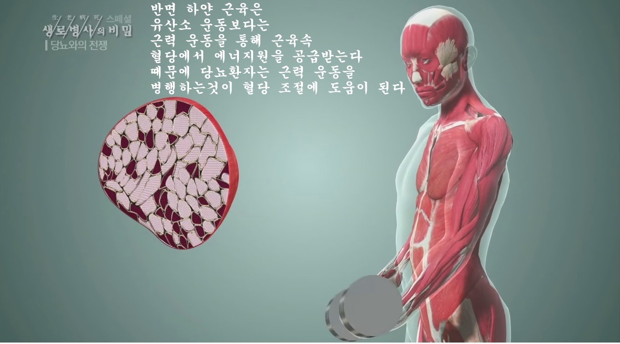 당뇨를 이긴 사람들의 운동법 | 인스티즈