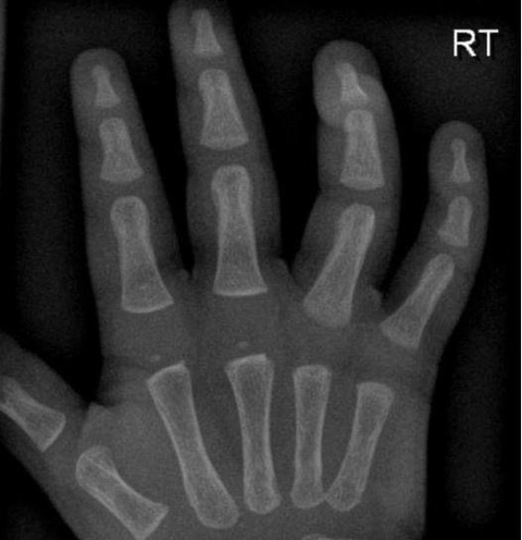아가들이 통통한 이유 | 인스티즈