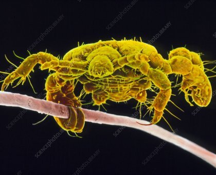 사면발이 확대 모습 .jpg (혐오주의) | 인스티즈