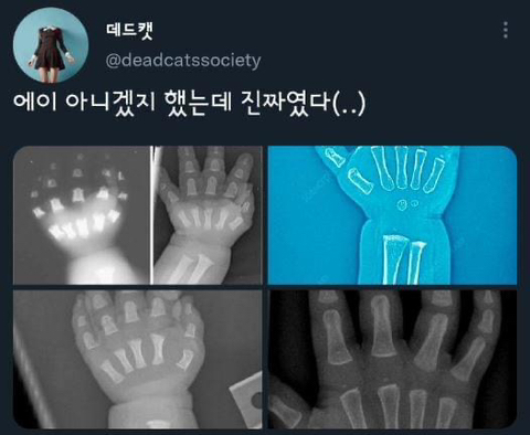 아가들이 통통한 이유 | 인스티즈