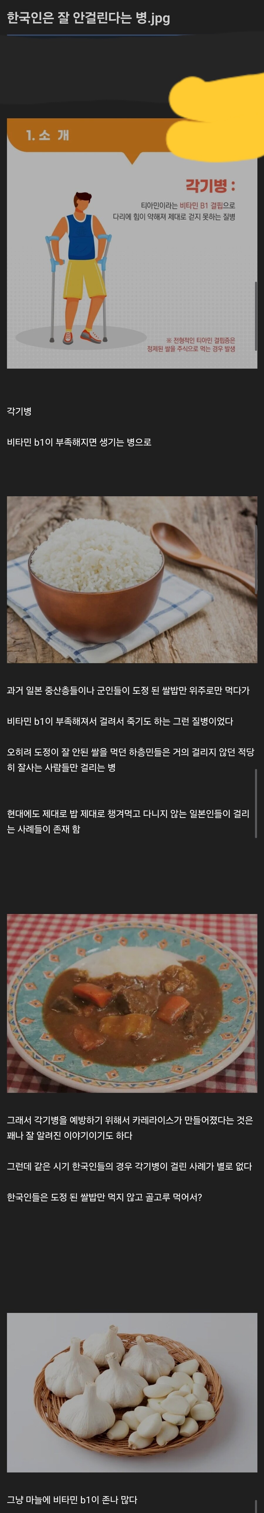 한국인은 잘 안걸리는 병 | 인스티즈