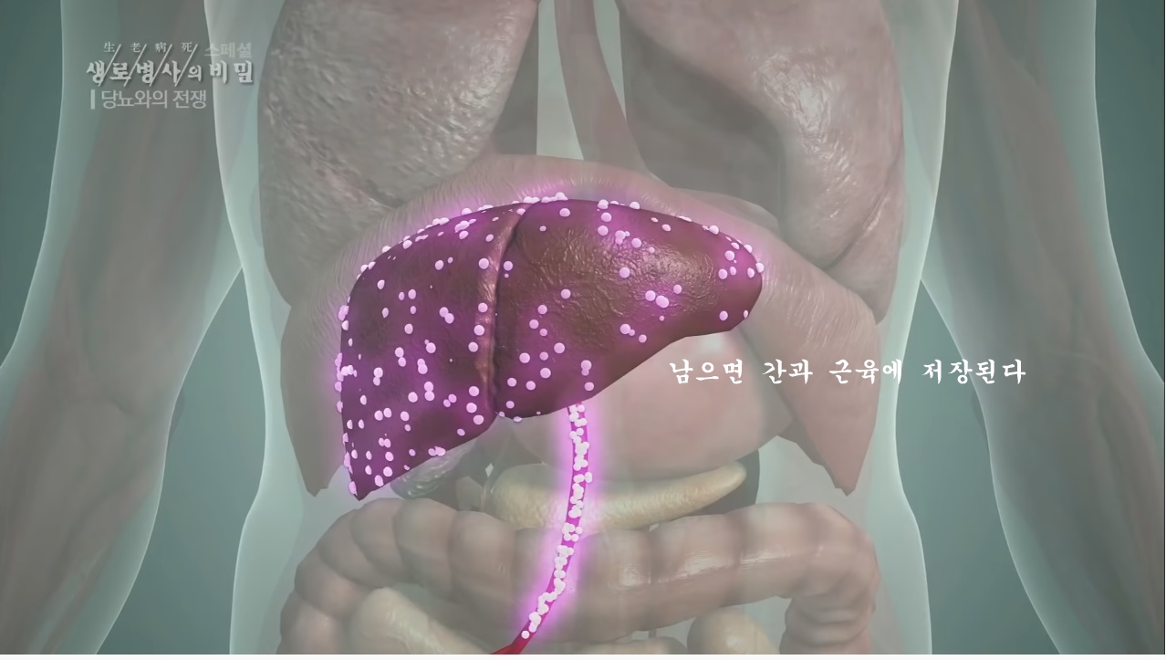 당뇨를 이긴 사람들의 운동법 | 인스티즈