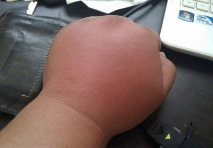 도라에몽 주먹좌 근황 | 인스티즈