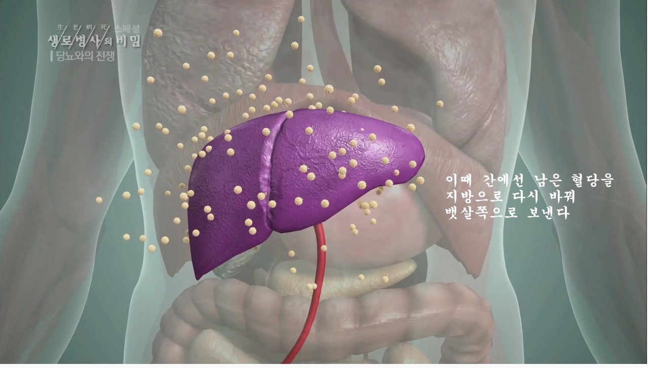 당뇨를 이긴 사람들의 운동법 | 인스티즈