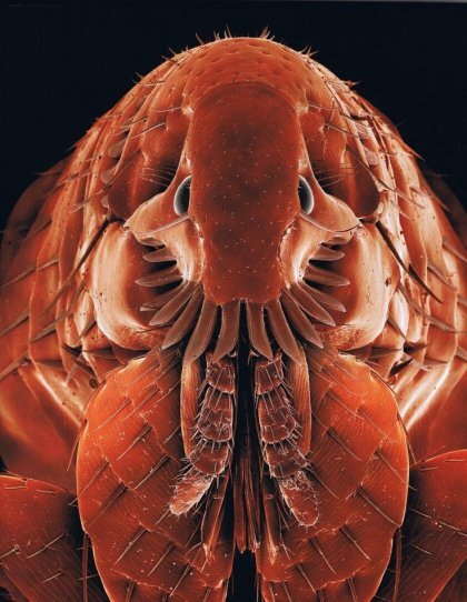 사면발이 확대 모습 .jpg (혐오주의) | 인스티즈