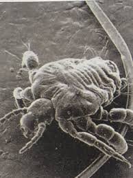 사면발이 확대 모습 .jpg (혐오주의) | 인스티즈