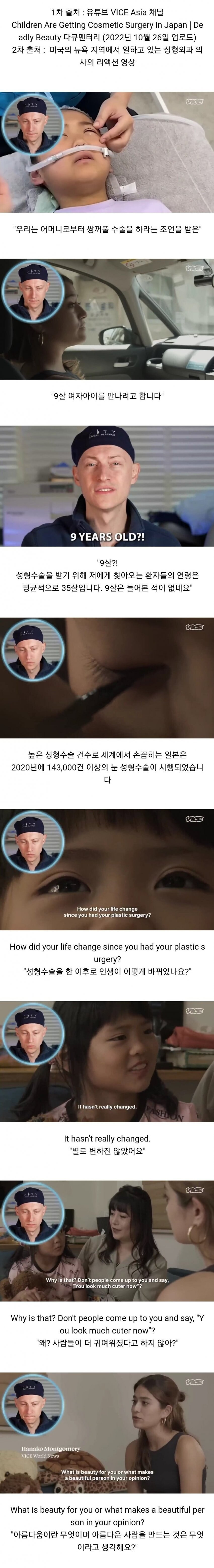 쌍꺼풀 성형수술 받은 일본 초등학생.jpg | 인스티즈