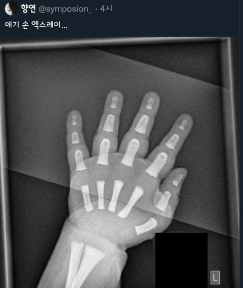 아가들이 통통한 이유 | 인스티즈