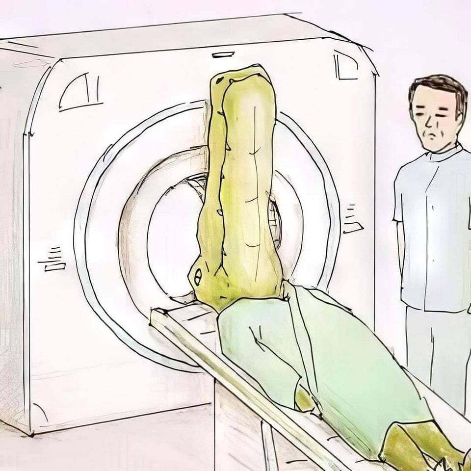 악어로 살면 생길 수 있는 문제들 | 인스티즈