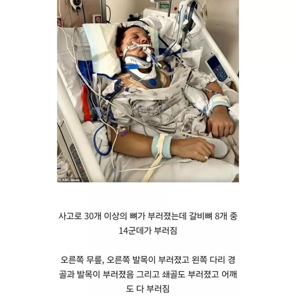 호크아이 제레미 레너 근황 | 인스티즈