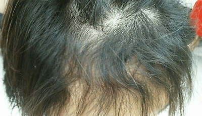 이런 곱슬 가진 사람 은근 있음 | 인스티즈