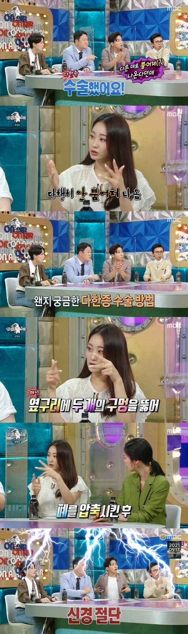 다한증 수술 받은 경리.jpg | 인스티즈