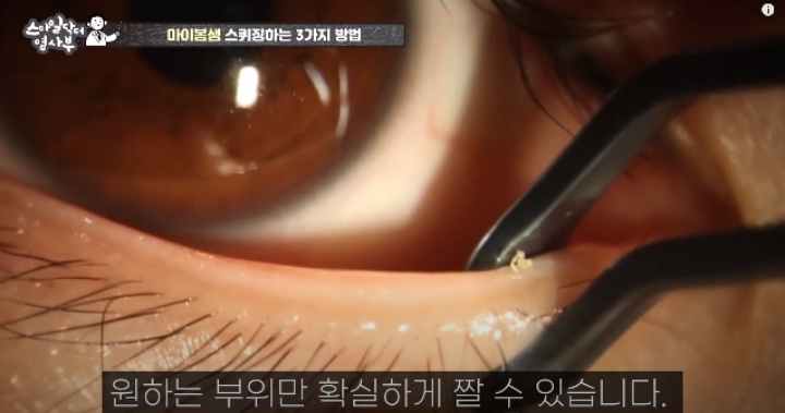 눈꺼풀에도 피지있는거 알아?? jpg (feat. 피르가즘) | 인스티즈