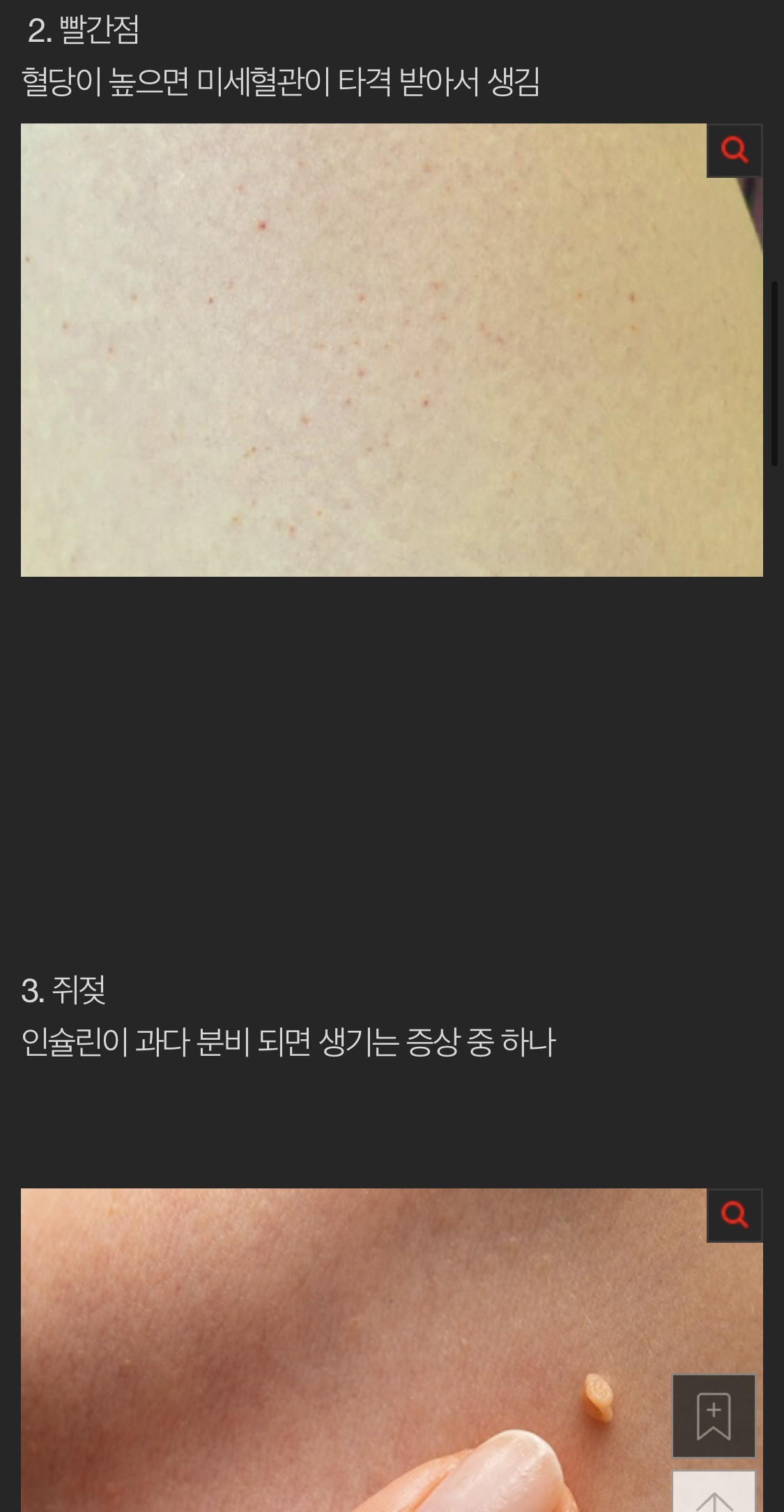 몸에 당수치가 높으면 생기는일들.jpg | 인스티즈