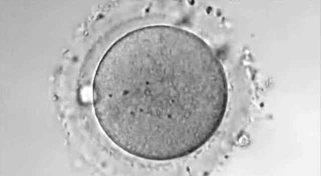 자연수정 vs 시험관 시술 직후 난자 차이.jpg | 인스티즈