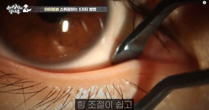 눈꺼풀에도 피지있는거 알아?? jpg (feat. 피르가즘) | 인스티즈