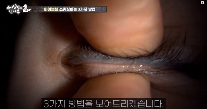 눈꺼풀에도 피지있는거 알아?? jpg (feat. 피르가즘) | 인스티즈