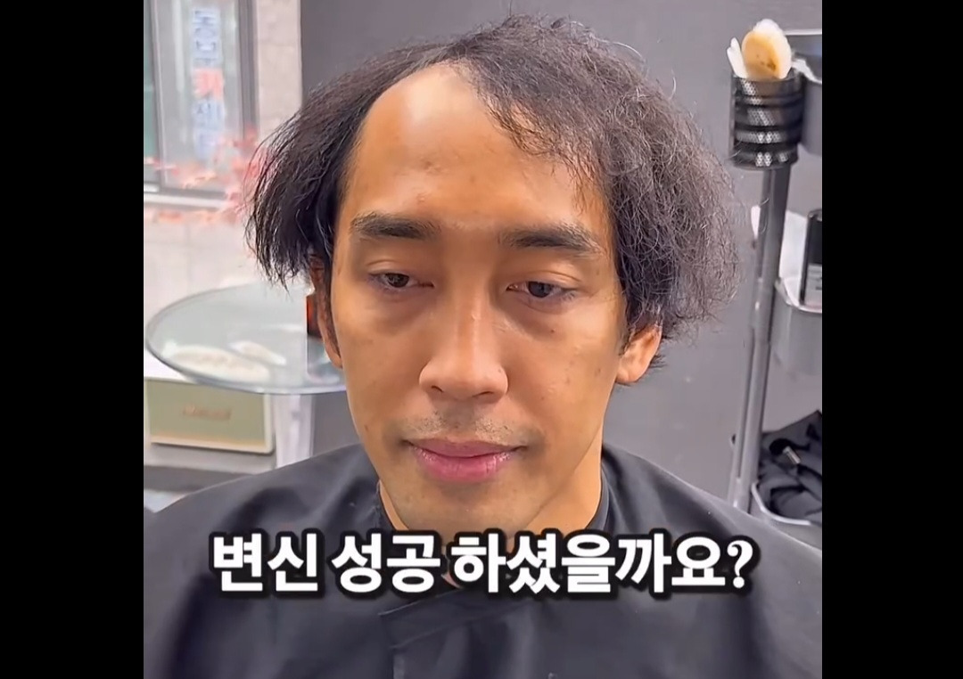 탈모가 있는데 헤어 가능할까요 | 인스티즈