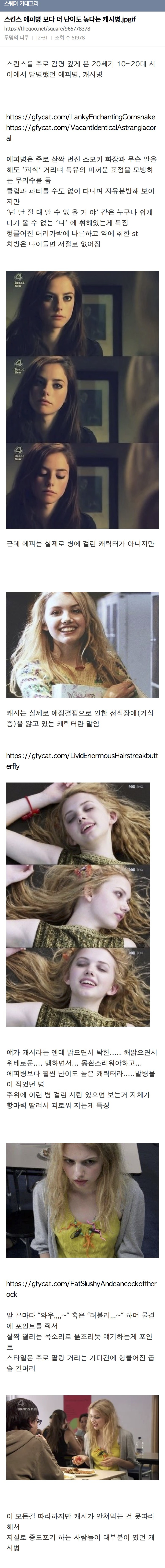 스킨스 에피병 보다 더 난이도 높다는 캐시병.jpgif | 인스티즈