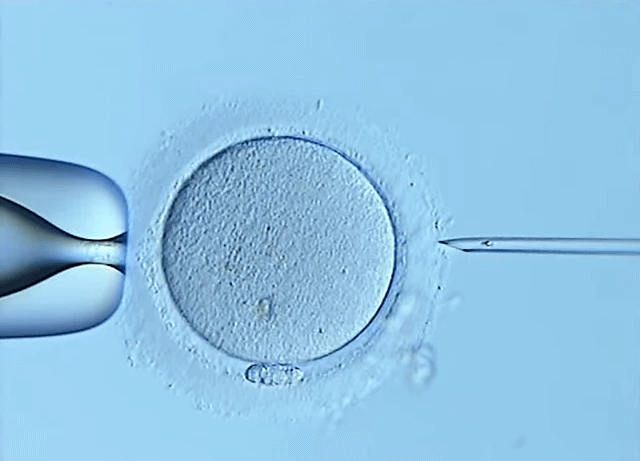 자연수정 vs 시험관 시술 직후 난자 차이.jpg | 인스티즈