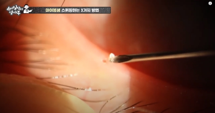 눈꺼풀에도 피지있는거 알아?? jpg (feat. 피르가즘) | 인스티즈