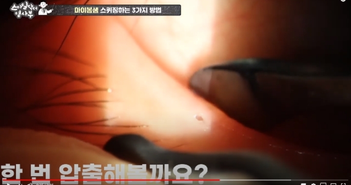 눈꺼풀에도 피지있는거 알아?? jpg (feat. 피르가즘) | 인스티즈