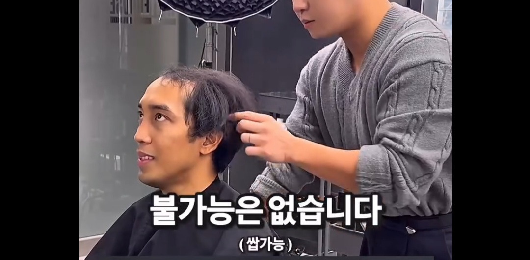 탈모가 있는데 헤어 가능할까요 | 인스티즈