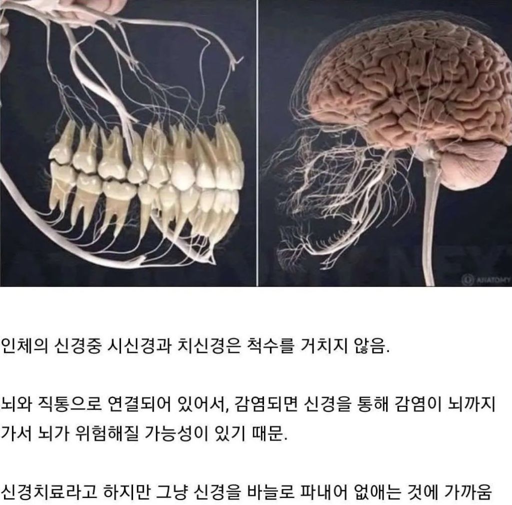 신경치료 하기 전에 치아관리 잘하자 | 인스티즈