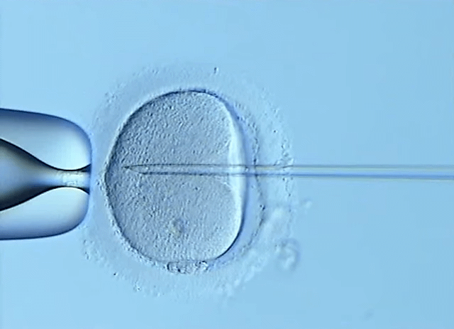 자연수정 vs 시험관 시술 직후 난자 차이.jpg | 인스티즈