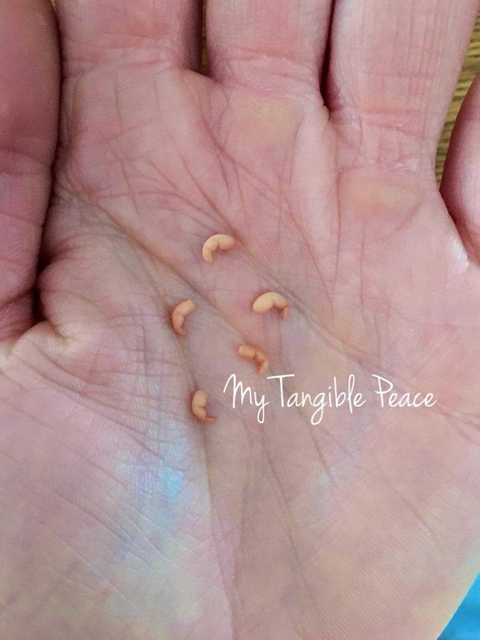 임신중절(낙태)에 반대하는 사람들에게 보여주고 싶은 사진 | 인스티즈