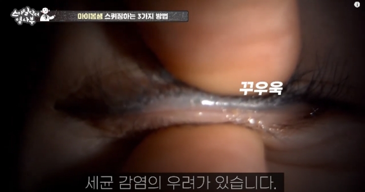 눈꺼풀에도 피지있는거 알아?? jpg (feat. 피르가즘) | 인스티즈