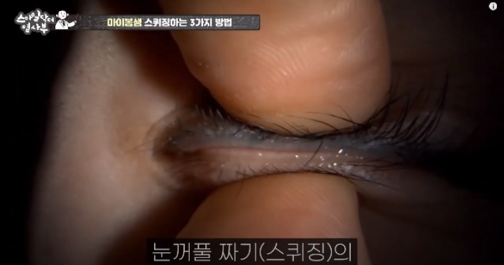 눈꺼풀에도 피지있는거 알아?? jpg (feat. 피르가즘) | 인스티즈