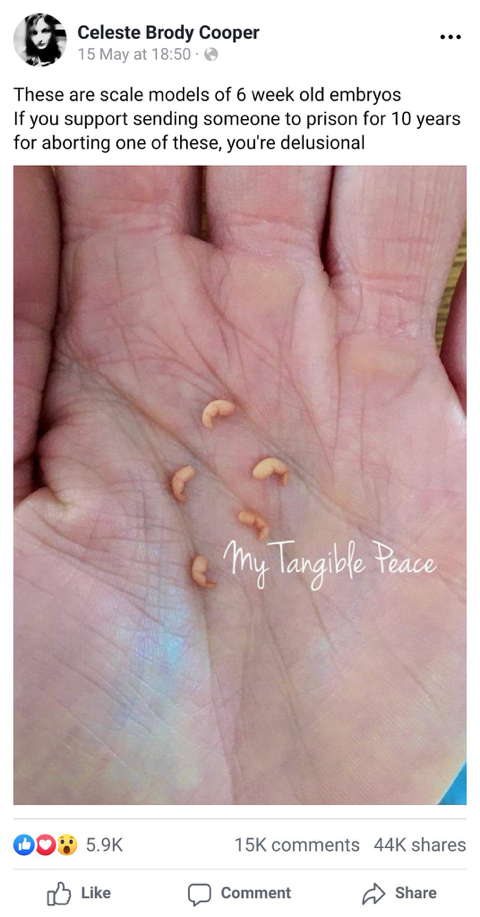 임신중절(낙태)에 반대하는 사람들에게 보여주고 싶은 사진 | 인스티즈