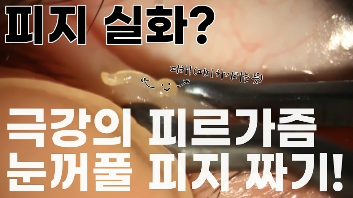 눈꺼풀에도 피지있는거 알아?? jpg (feat. 피르가즘) | 인스티즈