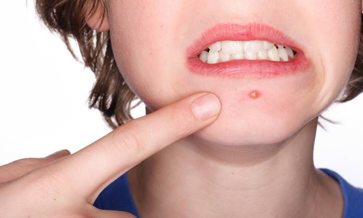 [고르기] 생리중일 때 가장 빡치는 것은? | 인스티즈