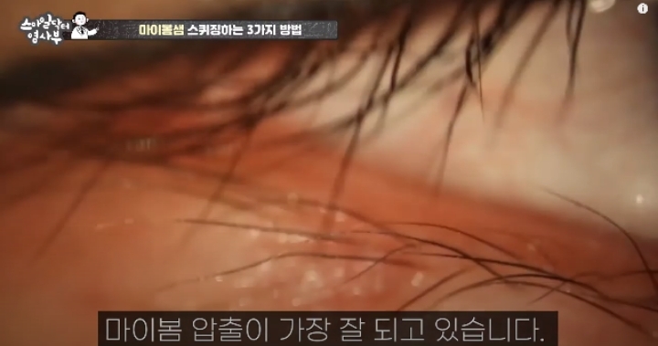 눈꺼풀에도 피지있는거 알아?? jpg (feat. 피르가즘) | 인스티즈